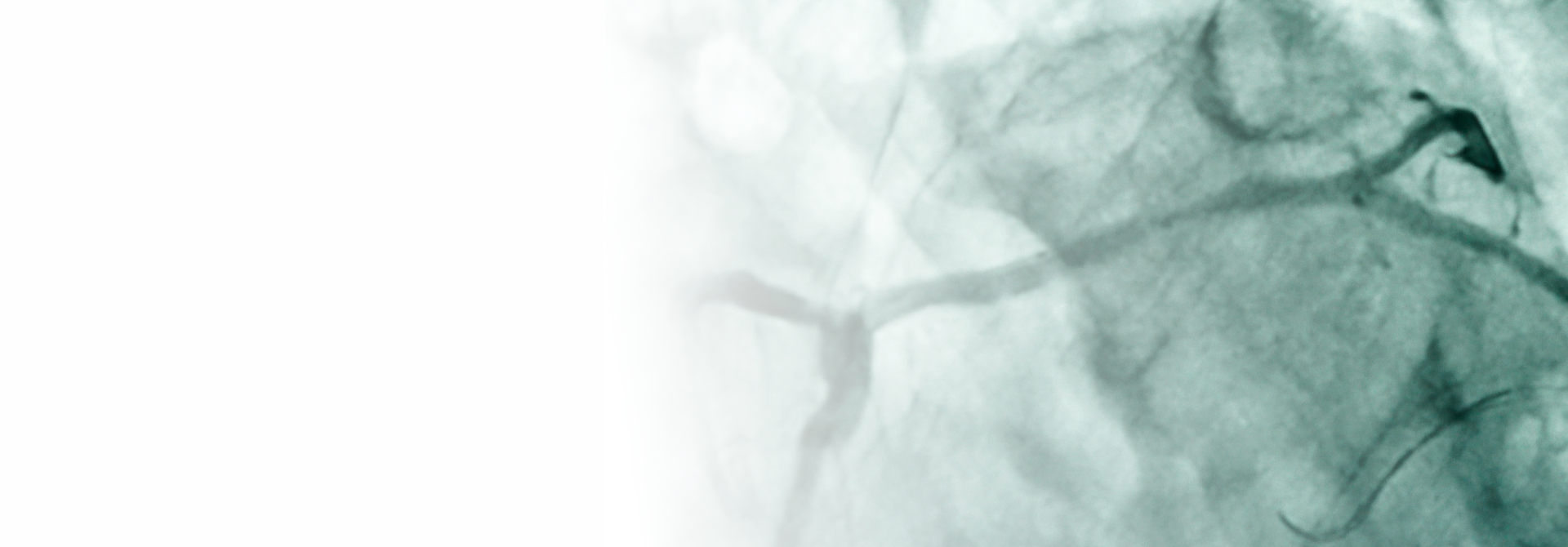 冠動脈造影画像